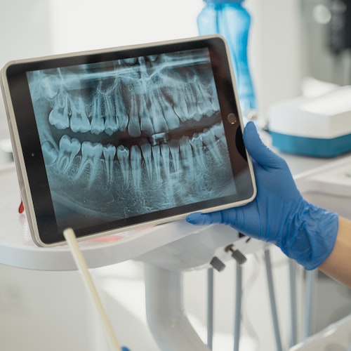 X-ray image of a jaw